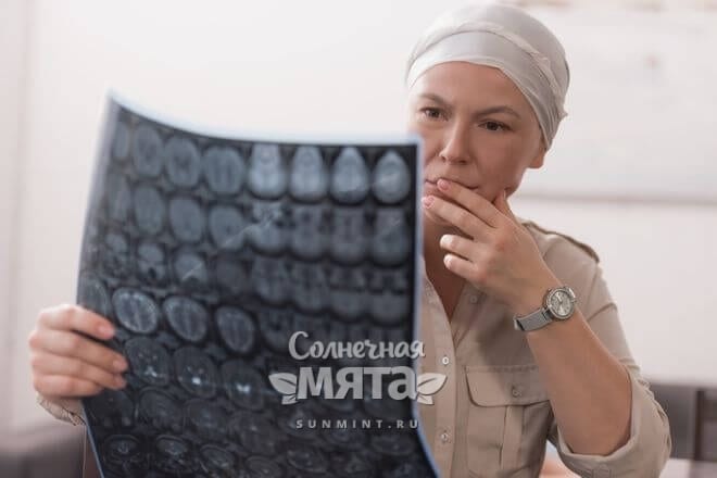 Женщина задумчиво смотрит на снимки своего мозга, фото